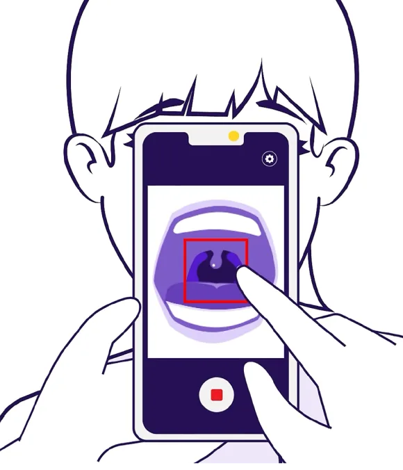 Solution Image